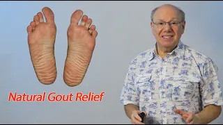 Natural Gout Relief