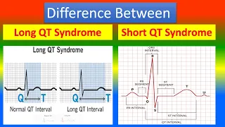 Difference between Long QT Syndrome  and  Short QT Syndrome