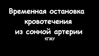 Временная остановка кровотечения из сонной артерии - meduniver.com