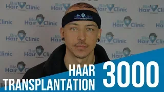 Haartransplantation Türkei Erfahrungen - Istanbul Bio Hair Clinic