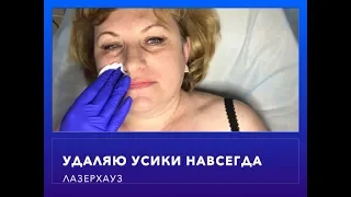 Удаляю усики в ЛазерХауз. Лазерная эпиляция. Удаление нежелательных волос на лице и теле навсегда