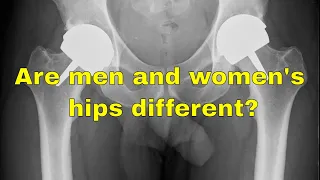 Are men and women's hips different?