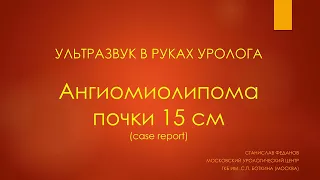 Ультразвук в руках уролога. Ангиомиолипома почки 15 см.