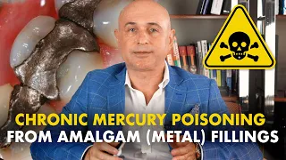 Amalgam (metal) fillings: Common symptoms of chronic mercury poisoning