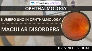 Numero uno in Ophthalmology: Macular Disorders | NEET-PG 2021 | Vineet Sehgal