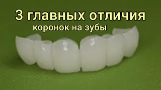 Как ВЫБРАТЬ коронки на зубы? Отличие КОРОНОК ортопедических. Где СТАВИТЬ зубные коронки?