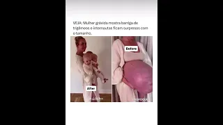 #gravidez #gravida #trigêmeos #trigemeas #gêmeos #shortsfeed #shortsvideo #shortvideo #shorts #short