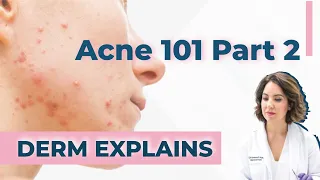 What is the best treatment to get rid of acne? - Dr. Heidi Goodarzi