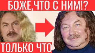 Только что! Боже, что с ним Игорь Николаев шокировал народ своей внешностью