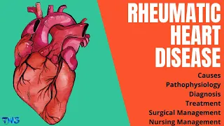 Rheumatic Heart Disease or RHD | Rheumatic Fever | Causes | Pathophysiology || The Nurses Station