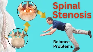 Spinal Stenosis and Balance Problems - 3 Ways To Improve Your Balance