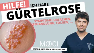 Gürtelrose 😱  Symptome, Behandlung, Ansteckung von Herpes Zoster