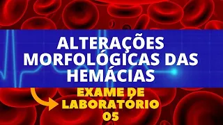 ANISOCITOSE, POIQUILOCITOSE, POLICROMASIA -  ALTERAÇÕES NO HEMOGRAMA - HEMATOLOGIA