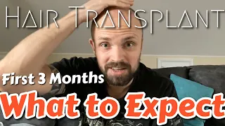 What to Expect in The First 3 Months After a Hair Transplant 2020