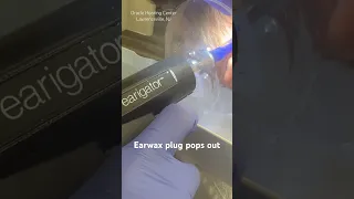 Earwax plug pops out (don’t blink)