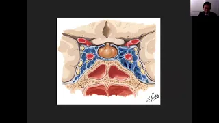 Pituitary & Sellar Imaging Part 2 | Health4TheWorld Academy