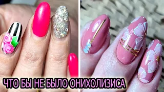 от ЭТОГО появляется ОНИХОЛИЗИС ❤ COSMOPROFI