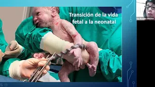 Intubación Endotraqueal en el Neonato - WEBINAR
