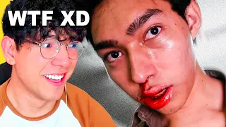 AMIGO QUÉ LE PASABA A FERNANFLOO 😱