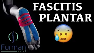 FASCITIS PLANTAR 🦶 Dolor en la planta del pie [Causas | Síntomas | Tratamientos]