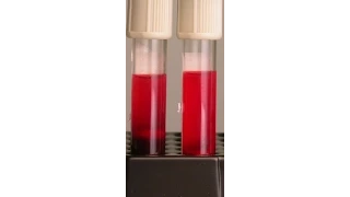 Preventing Hemolysis in the Blood Samples You Draw