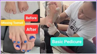 Doing Pedicure for my client with a missing toenail | Foot Maintenance #pedicure #nailtech #nails