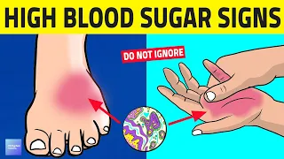 7 Alarming Signs Your Blood Sugar Is Too High