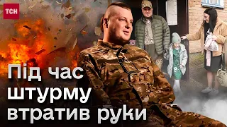 💔 Заплакав, коли дружині розказали, що він втратив руки! А він просив протези, щоб обіймати дітей