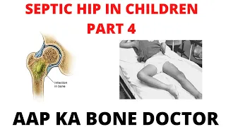 SEPTIC HIP JOINT IN CHILDREN - PART 4 - EPISODE 21
