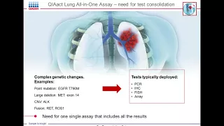 Live in 30 Days An NGS Workflow for Your Lab