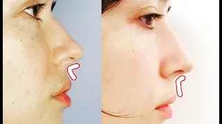 Make PHILTRUM shorter (simple face exercise)