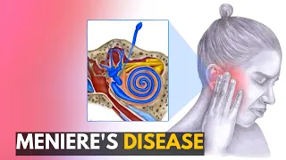 Meniere's disease: Everything You Need to Know