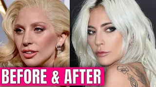 Lady Gaga: Plastic Surgery (2020)