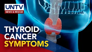 Maraming Pilipino, nagkakaroon ng thyroid cancer; sakit, maaaring lagpasan kung maagapan