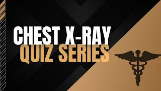 Chest X-ray Quiz Series