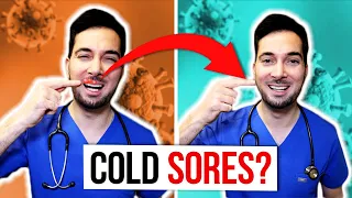 How to get rid of cold sores on lips fast and treatment