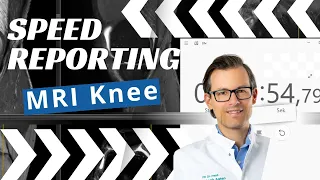 Speed vs. Accuracy: Knee MRI Analysis Showdown!