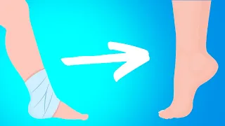 Best Ankle Rehabilitation Exercises for an Ankle Injury (Sprain or Fracture)