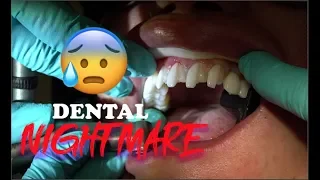 Dental Horror Story - Find Out Why You Should Get Veneers From The Right Dentist!