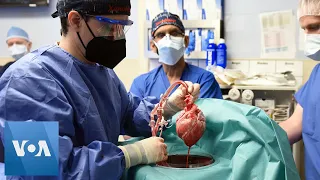 Doctors Transplant Pig Heart into Human for 1st Time