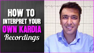 How to interpret your own Kardia recordings