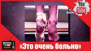 Изуродованные ноги Волочковой шокировали медиков