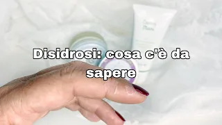 Disidrosi: cosa c’è da sapere e come trattarla