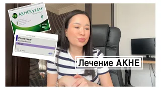 ЛЕЧЕНИЕ АКНЕ | Акнекутан и Роаккутан 😱