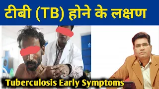 Tuberculosis [TB] ke Shuruaati Sanket kya hote hai | How to identify Symptoms of TB