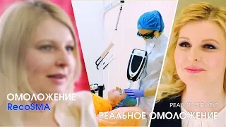 ОМОЛОЖЕНИЕ ЛИЦА / Лазерное омоложение RecoSMA