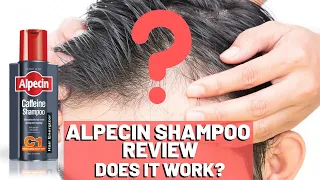Alpecin Shampoo Review - Do We Recommend It???