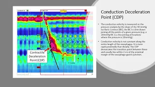 High resolution oesophageal manometry - Part 4 - Interpretation of results