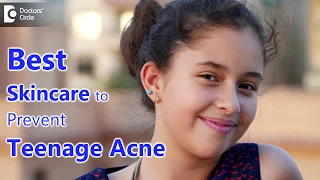 How to treat teenage acne? - Dr. Deepak P Devakar