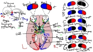 Visual Pathway and Lesions